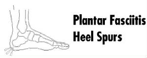 plantarfaciitis.jpg